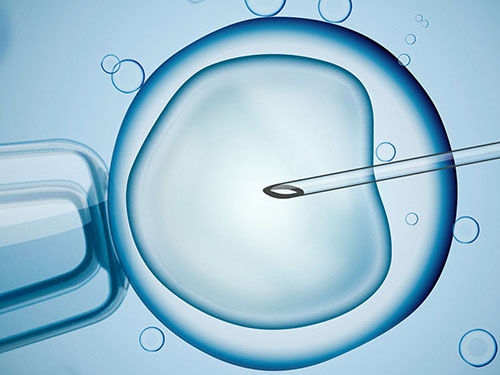 IVF Treatment-3